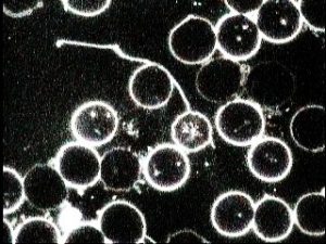 Contaminación Biológica Parásitos
