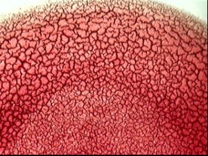 campo claro sangre y plasma normal