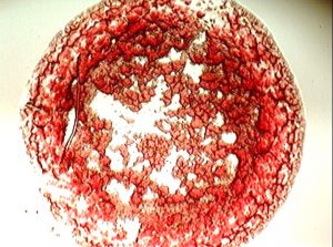 campo claro sangre y plasma patológico