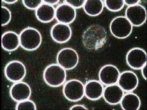 campo oscuro sangre y plasma normal