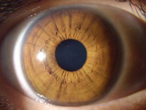 muestra primera de un iris