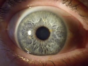 muestra quinta de un iris
