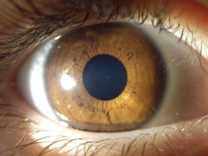 muestra segunda de un iris