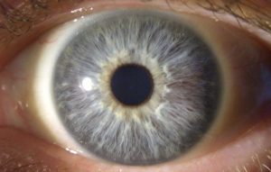 muestra sexta de un iris